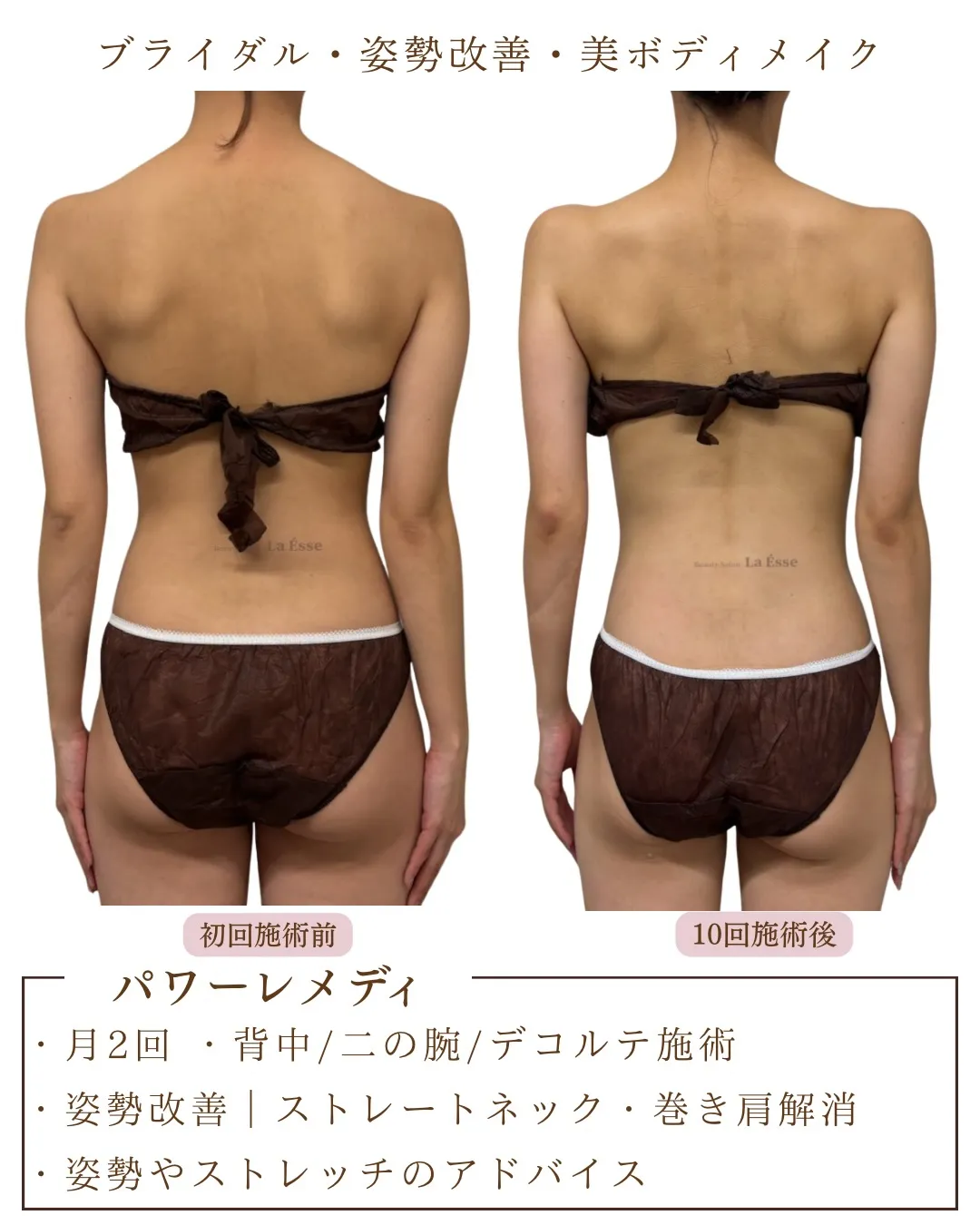 花嫁様必見!華奢感はつくれます👰🏻♀️✨