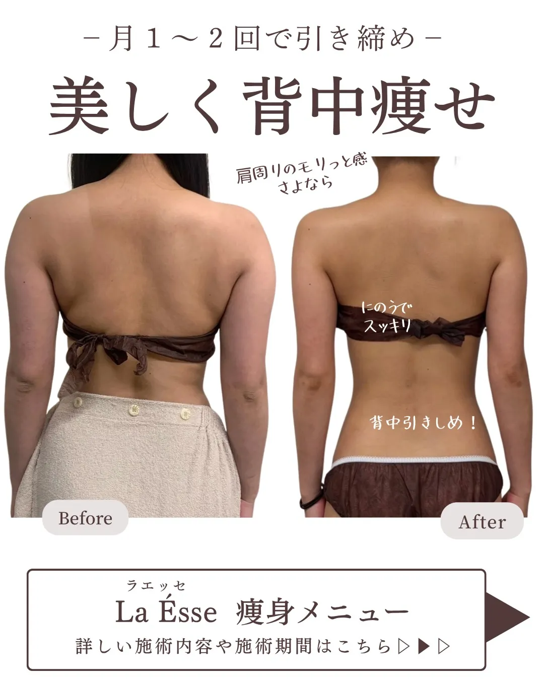 ここまで別人級に変わるならやるしかない!烏丸痩身サロン💪🏻