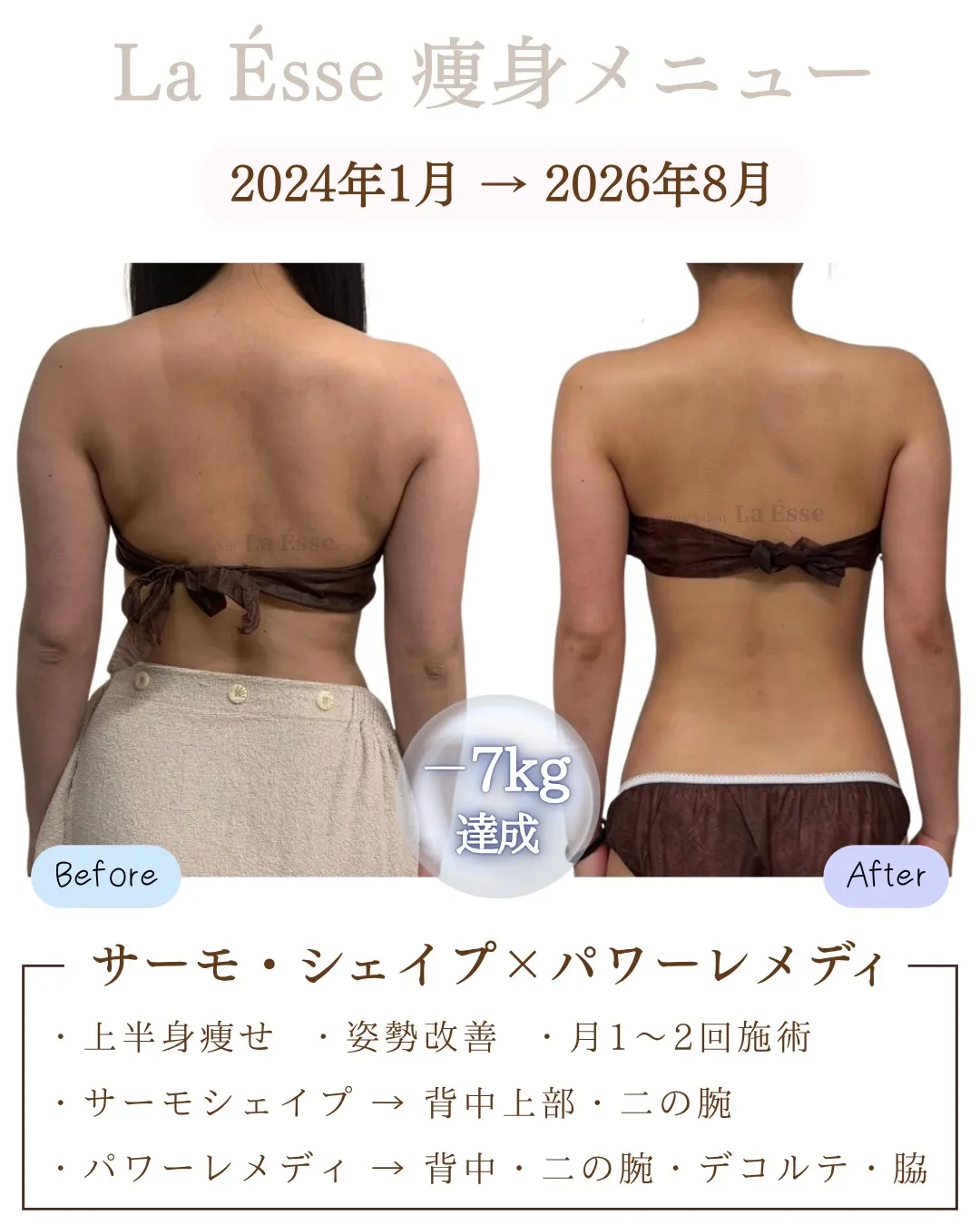 ここまで別人級に変わるならやるしかない!烏丸痩身サロン💪🏻