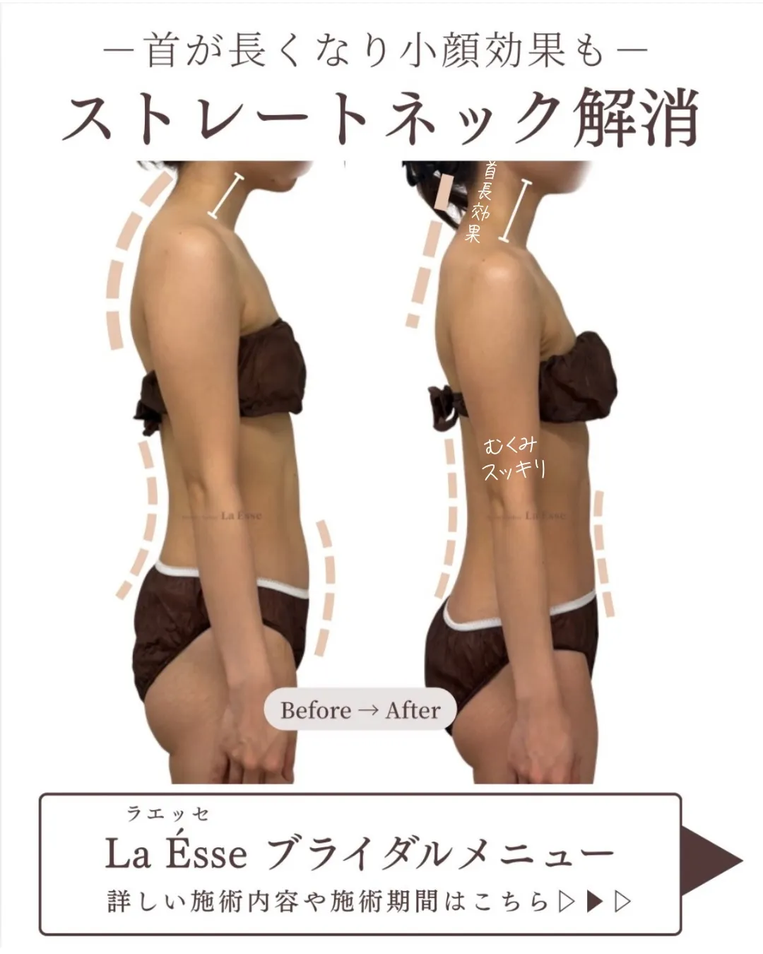 ストレートネック改善で、首長効果&小顔効果𝗚𝗘𝗧！