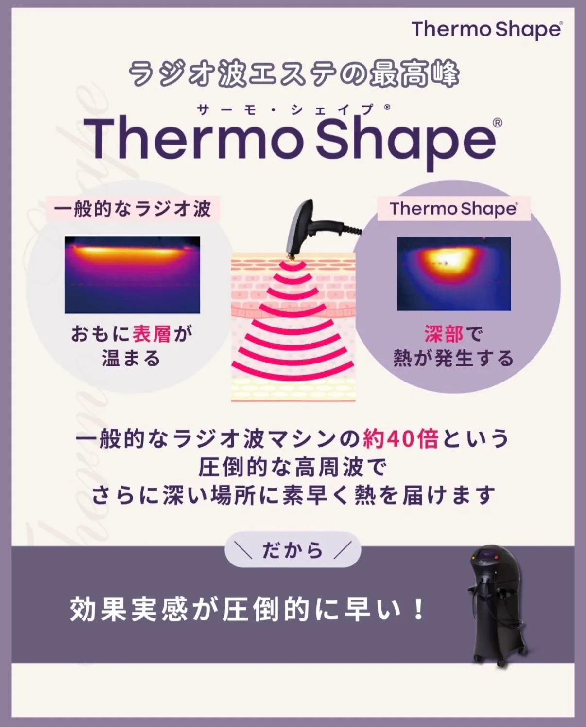 一度受けたら、また受けたくなる!サーモ・シェイプOpus 🔥