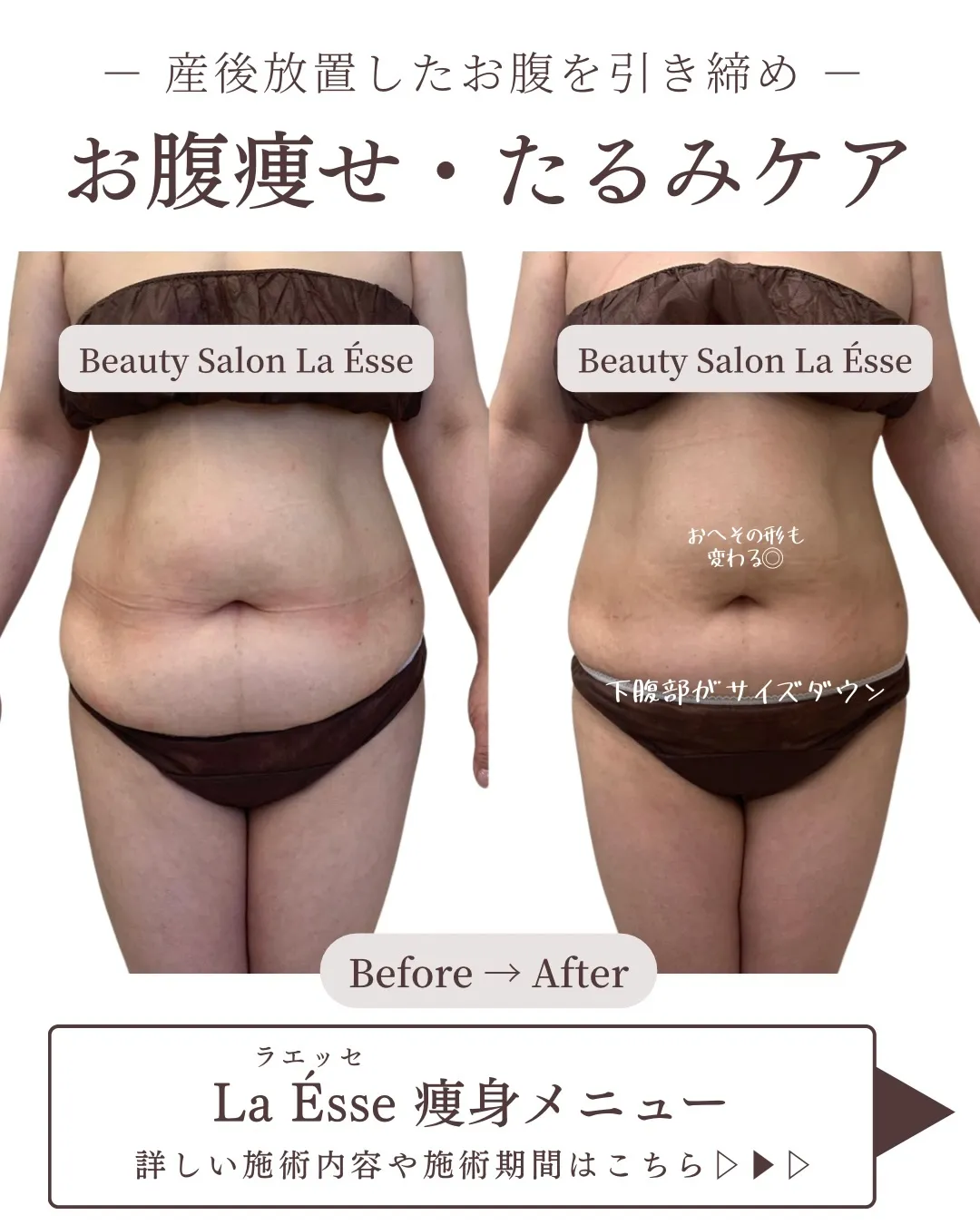 【産後太り・皮膚のたるみに同時アプローチ🪄】