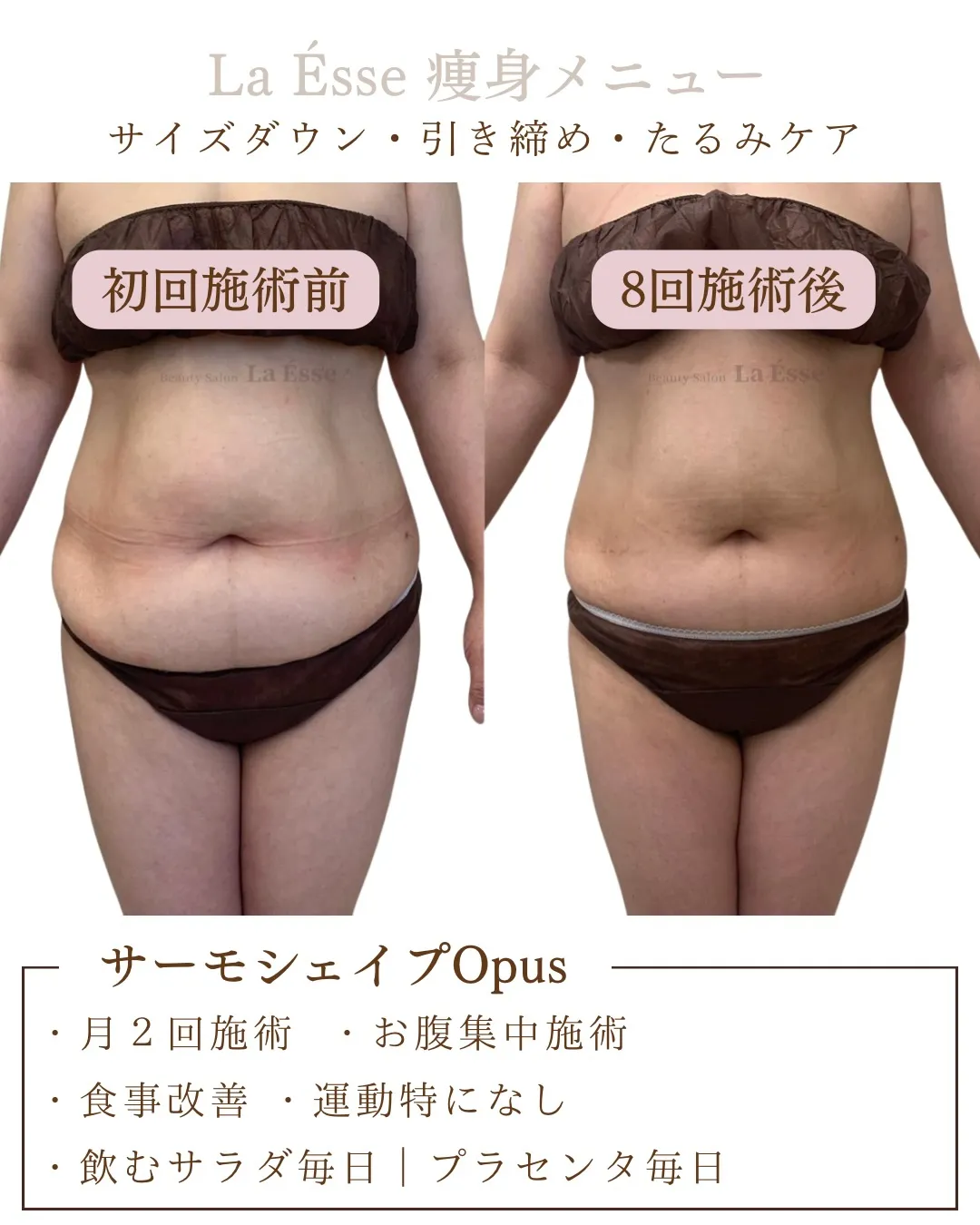 【産後太り・皮膚のたるみに同時アプローチ🪄】