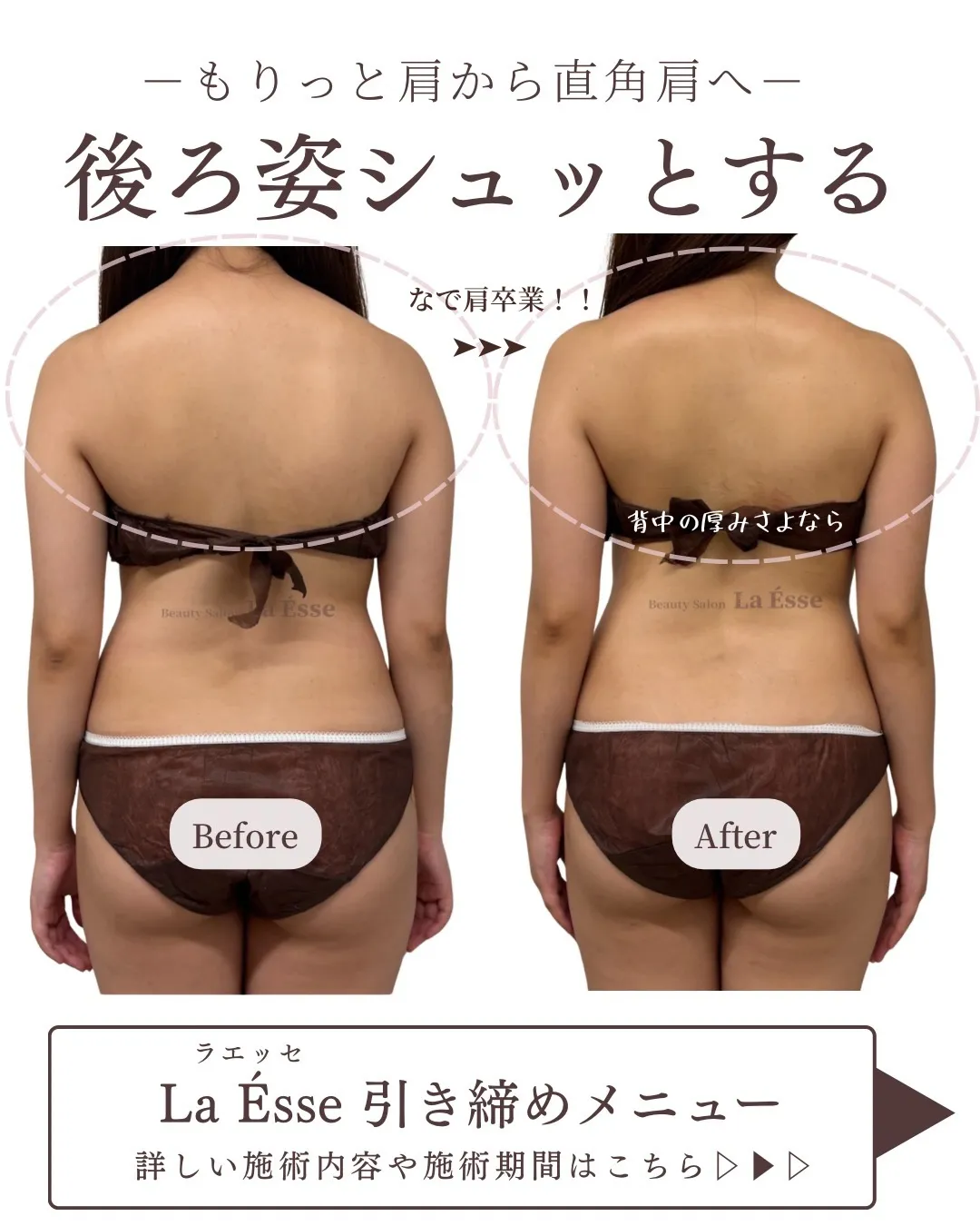 肩周りの厚みとモリっと感解消！！なで肩からの卒業🌸