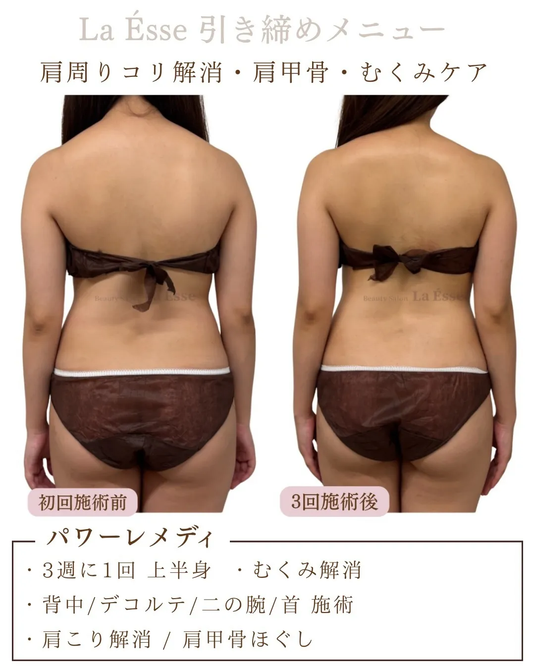 肩周りの厚みとモリっと感解消！！なで肩からの卒業🌸