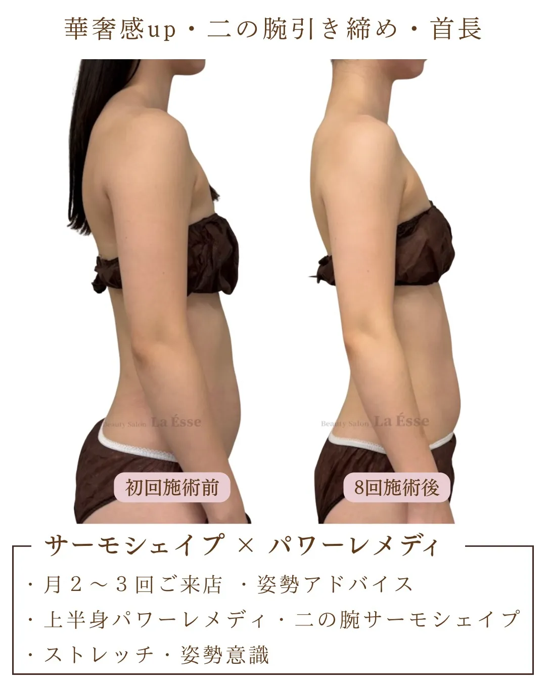 上半身のお悩み・ブライダルエステはお任せください💪🏻
