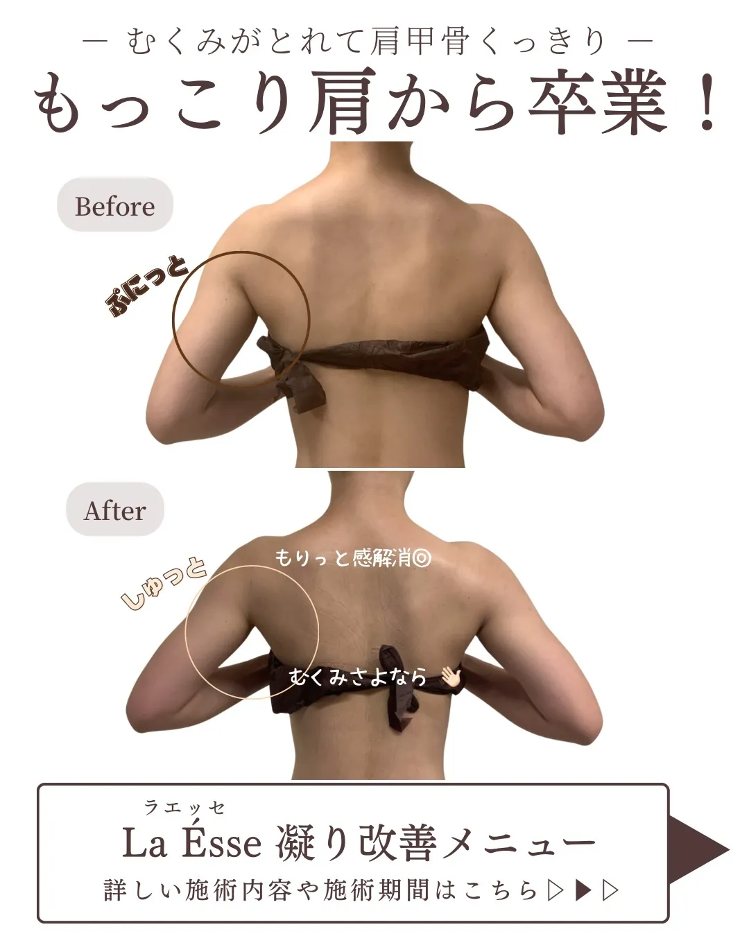 姿勢改善&もりっと感解消を同時に💪🏻 心地いい施術で美ボディ...