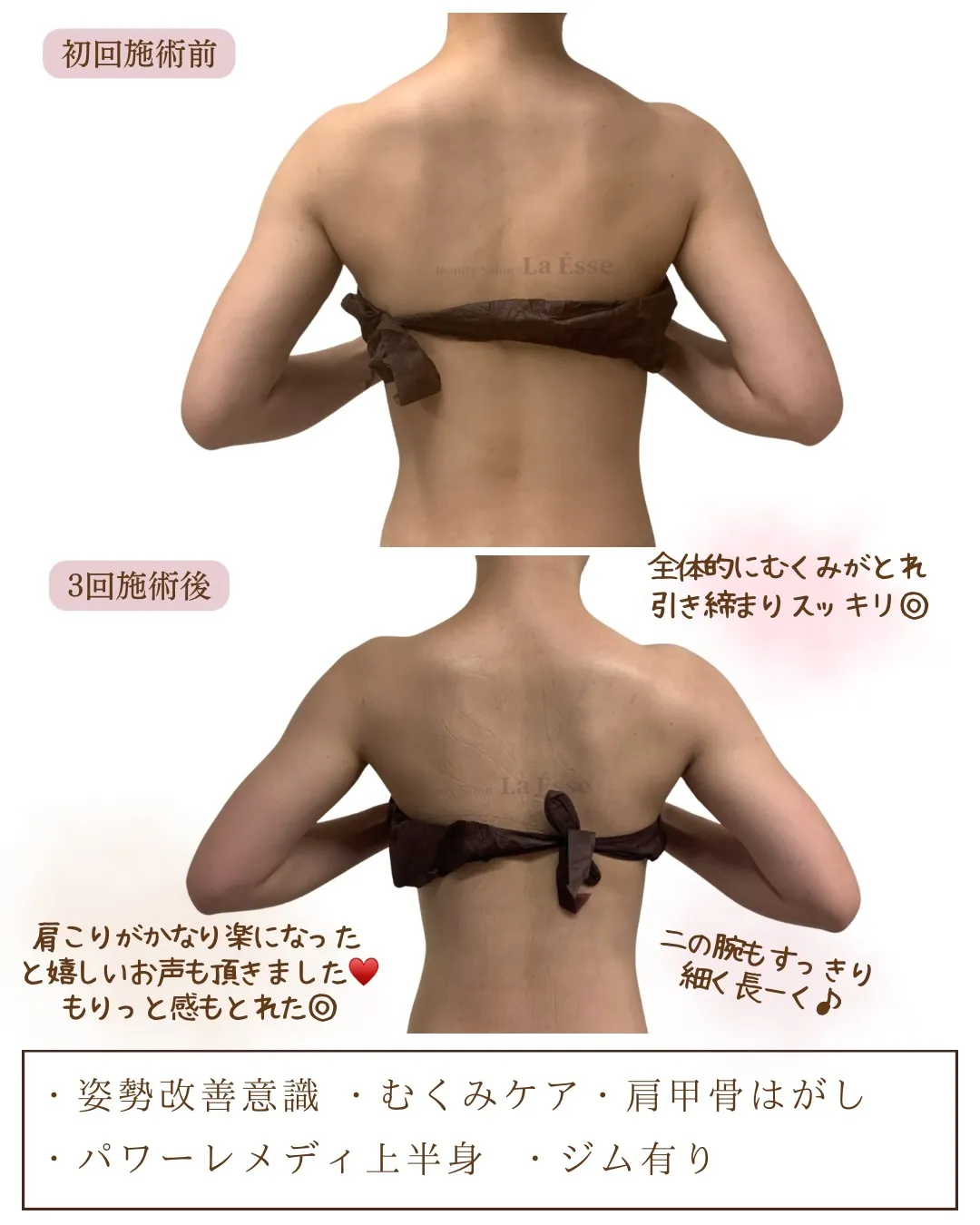 姿勢改善&もりっと感解消を同時に💪🏻 心地いい施術で美ボディ...