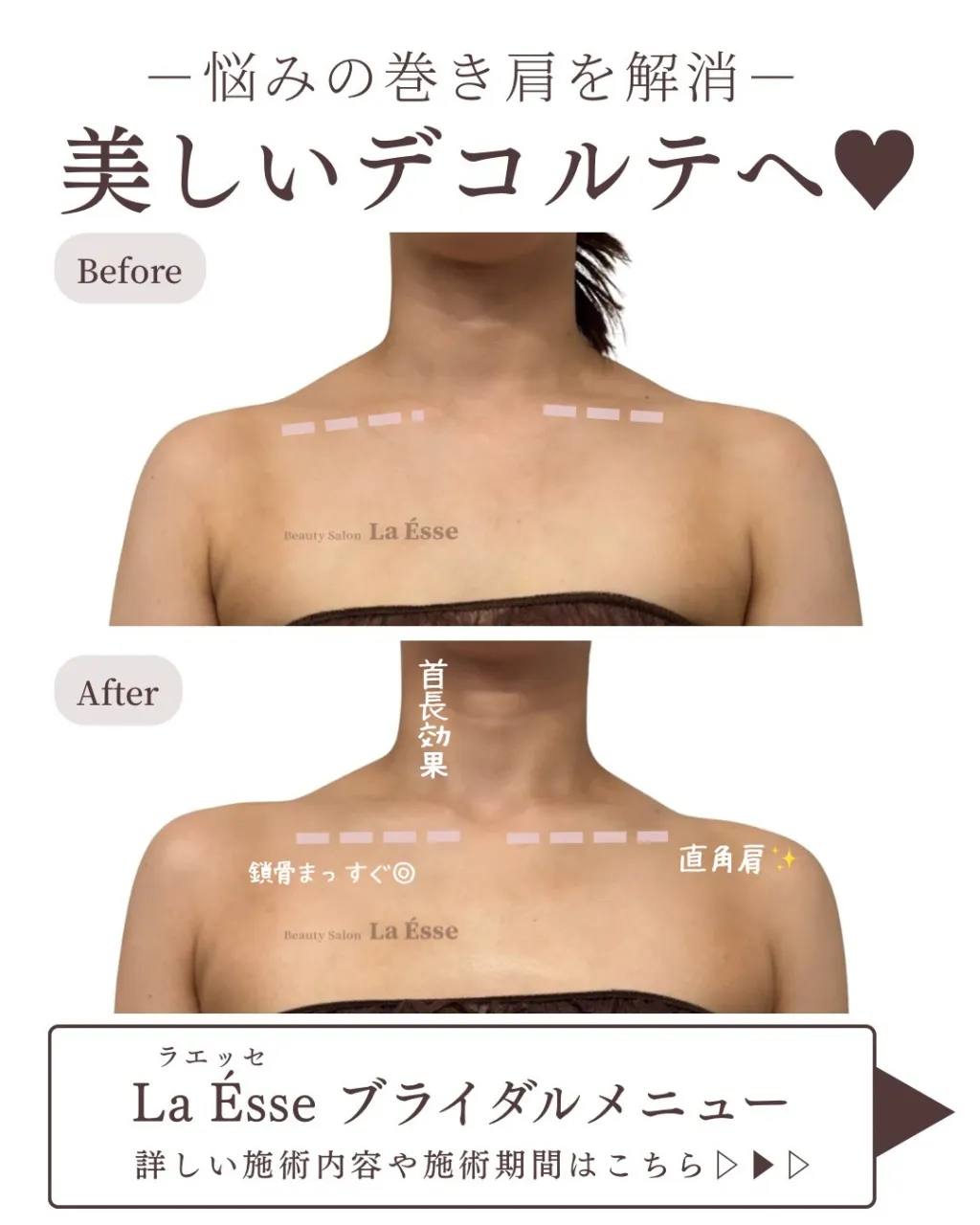 もりっとした肩から卒業‼️ 花嫁様には絶対嬉しいデコルテ𝐆𝐄...
