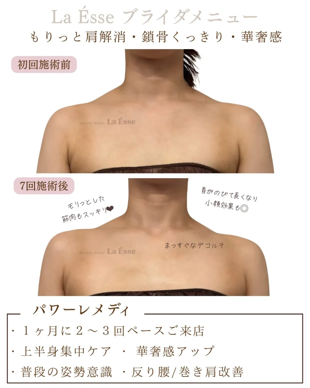 もりっとした肩から卒業‼️ 花嫁様には絶対嬉しいデコルテ𝐆𝐄...