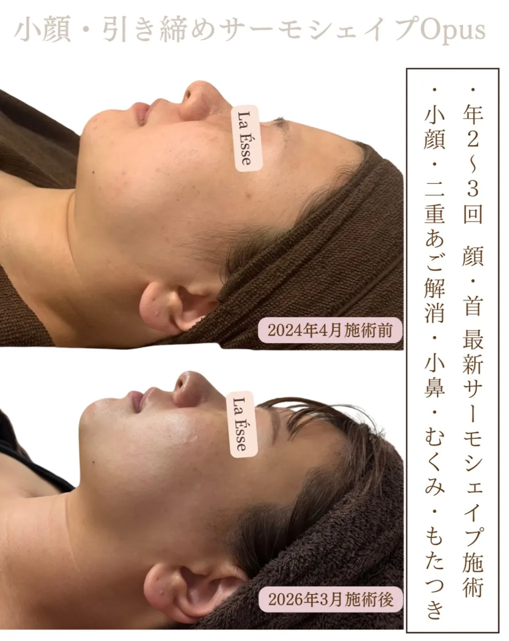 効果がすごいとのお声続出フェイシャル施術！今よりさらに美しい...