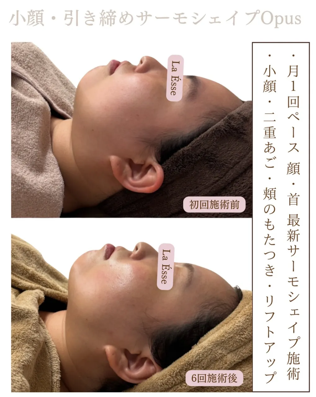 効果がすごいとのお声続出フェイシャル施術！今よりさらに美しい...