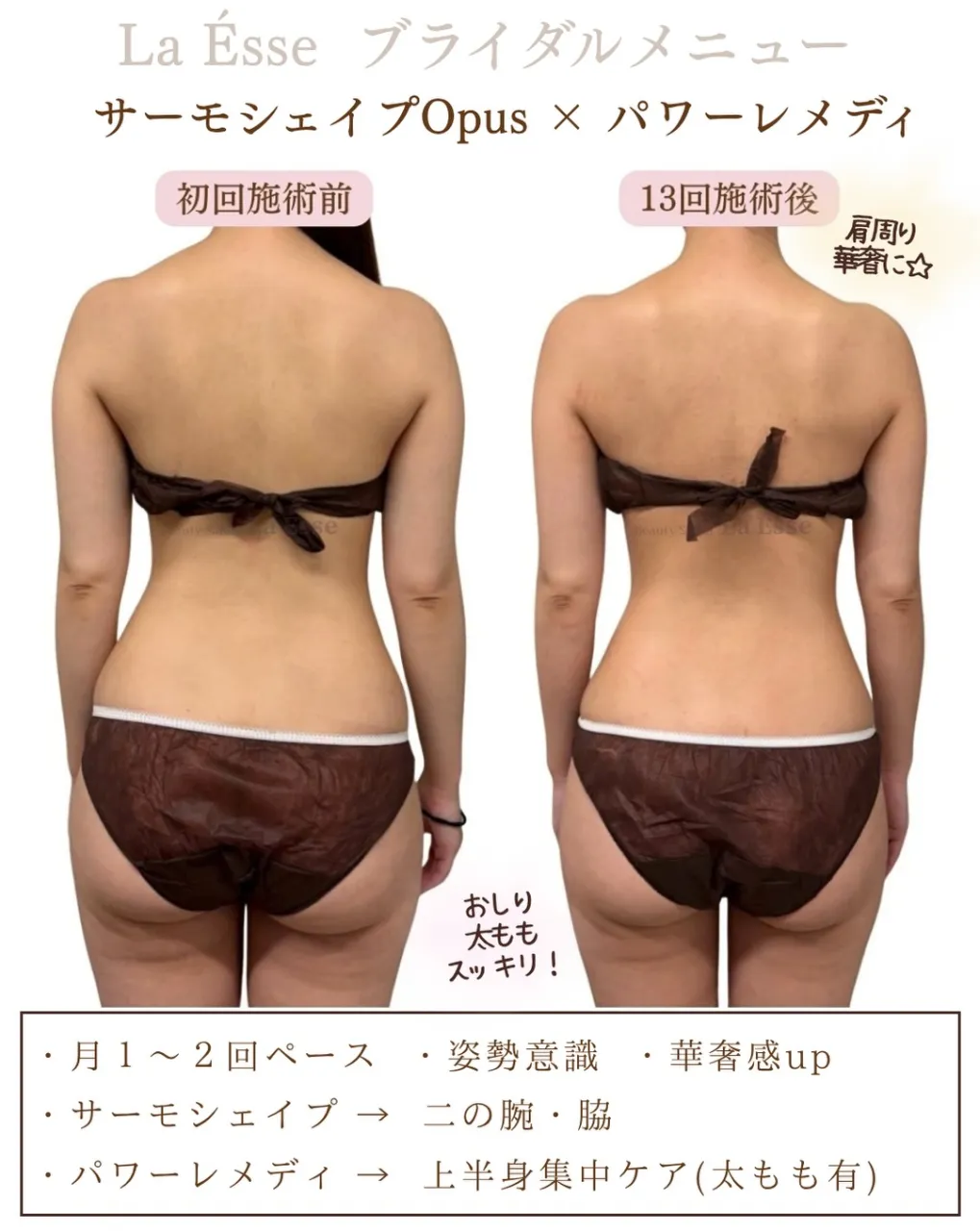 背中の厚みもとれドレス映えするお背中へ👰🏻♀️💎