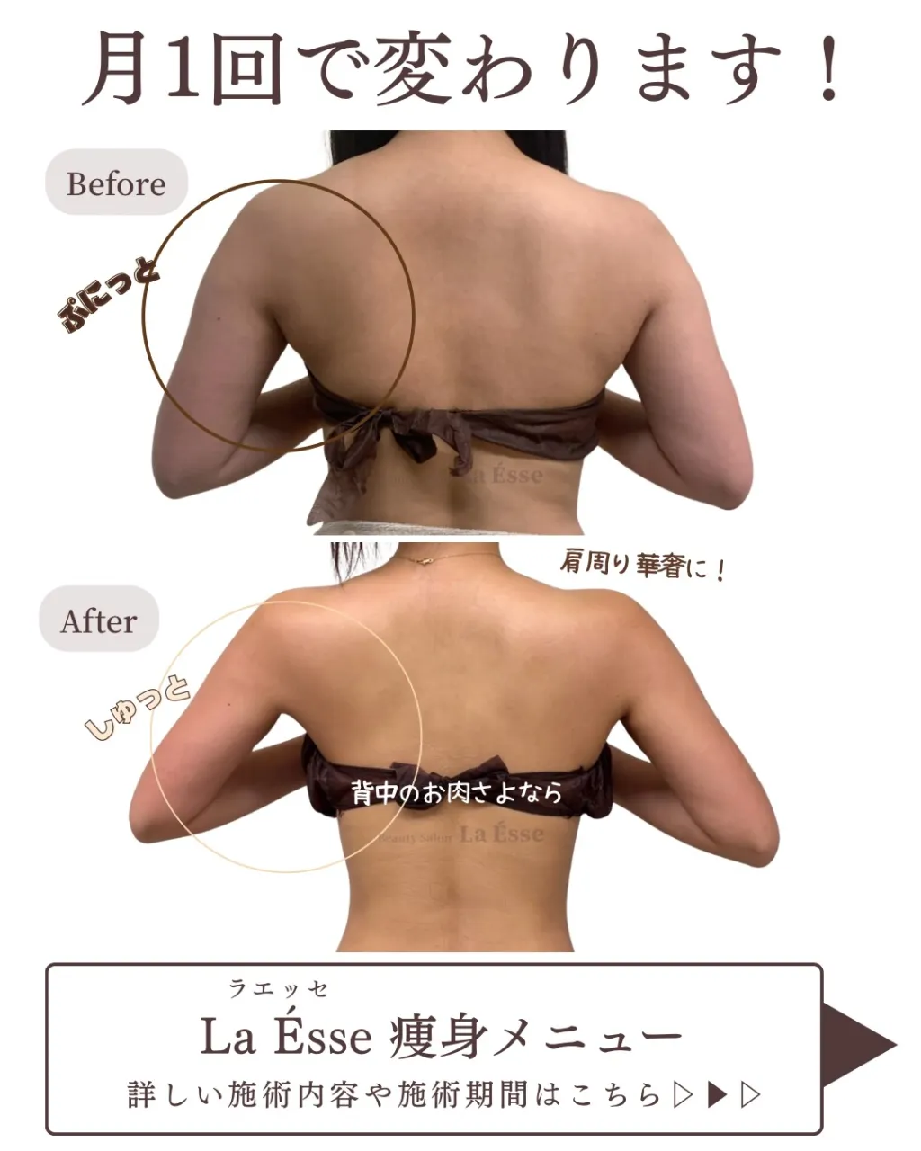 ここまで⁡別人級に変わるならやるしかない！烏丸痩身サロン💪🏻