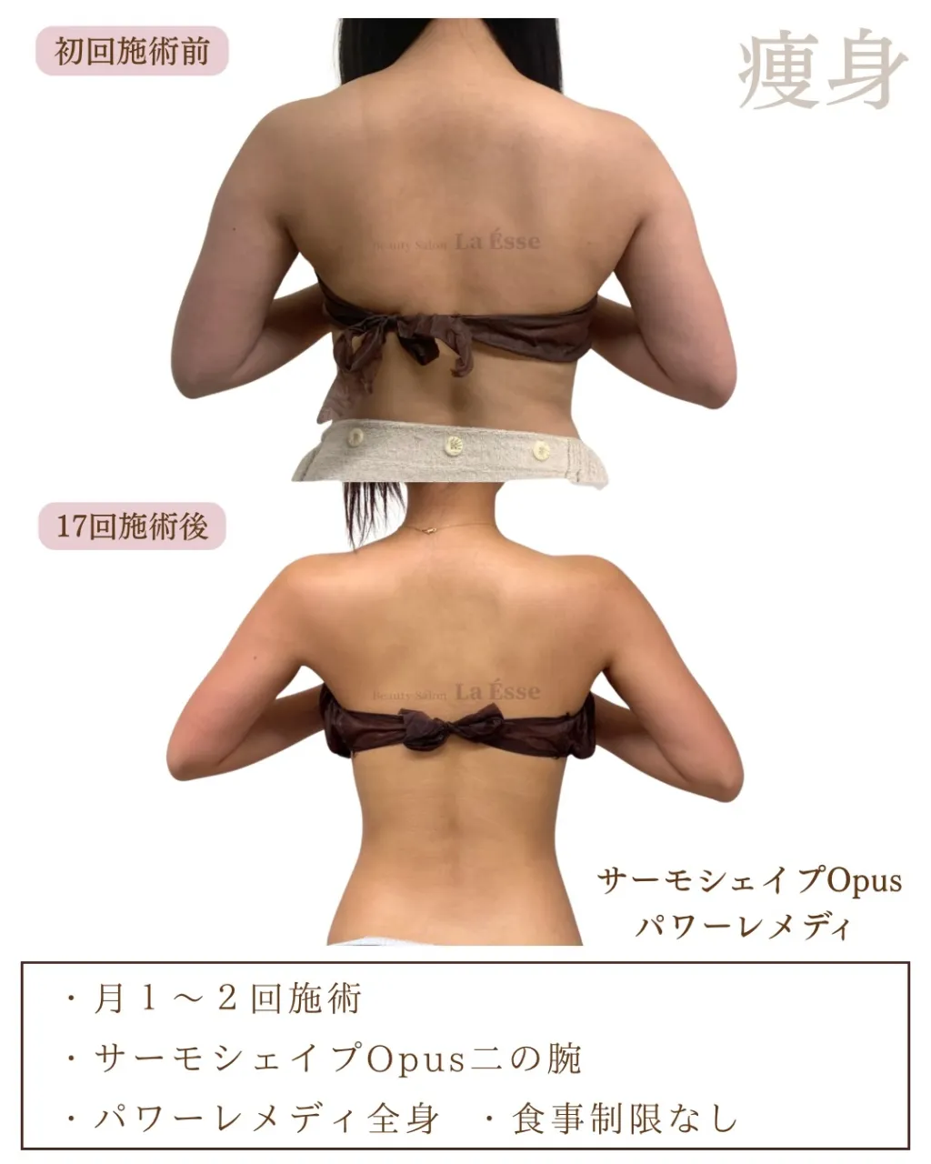 ここまで⁡別人級に変わるならやるしかない！烏丸痩身サロン💪🏻