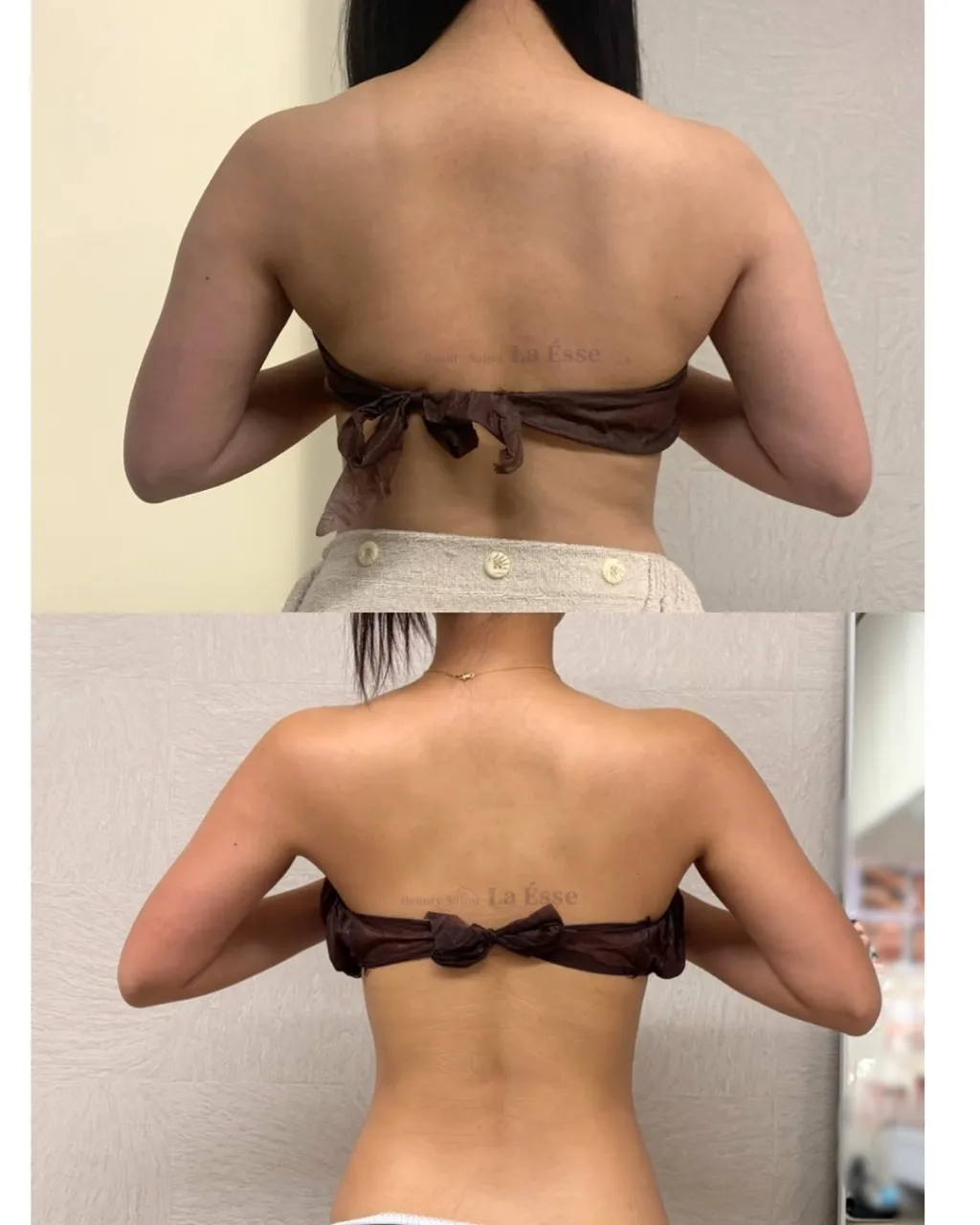 ここまで⁡別人級に変わるならやるしかない！烏丸痩身サロン💪🏻