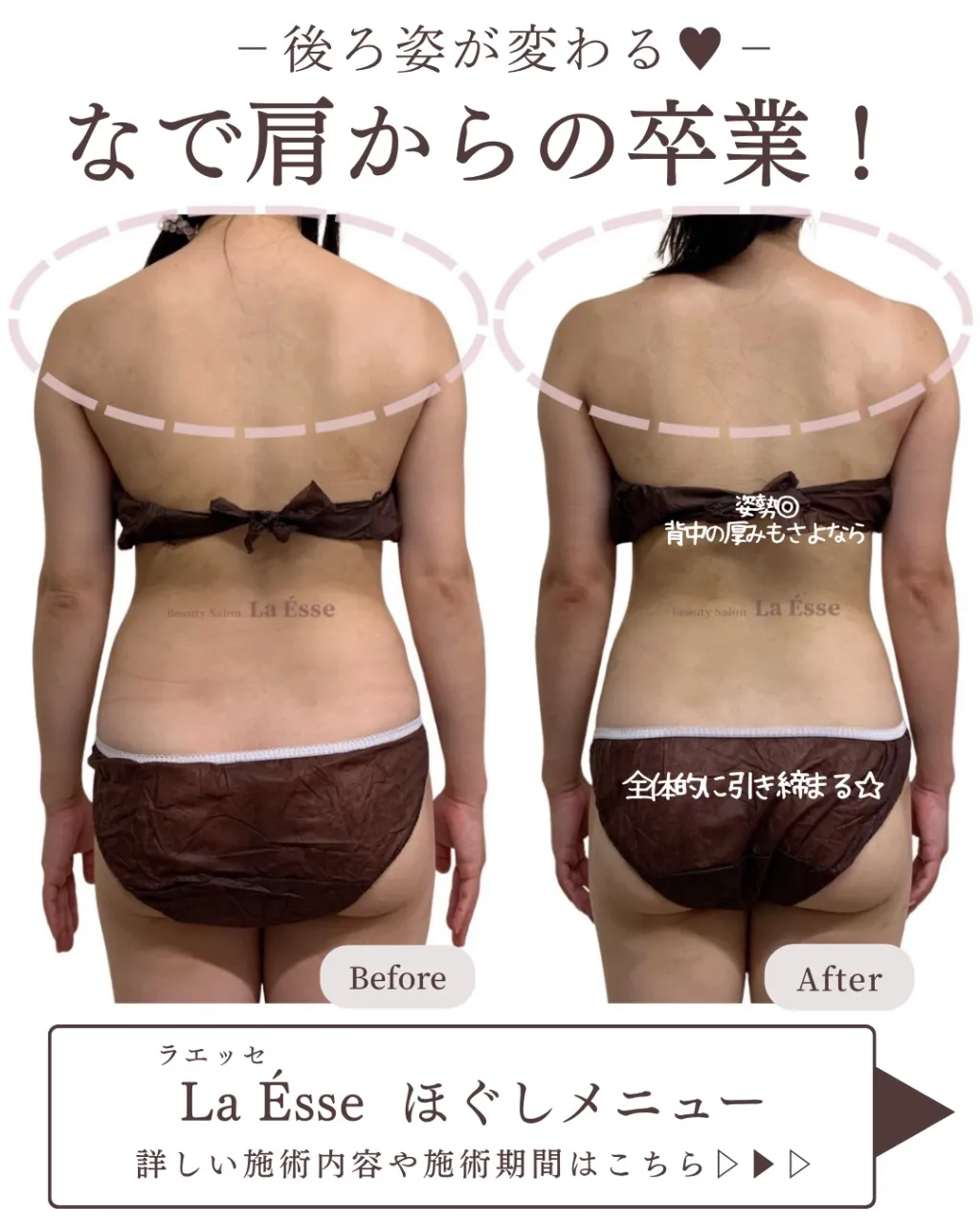 ３回筋膜リリースでなで肩から卒業へ✨ 背中スッキリ‼️
