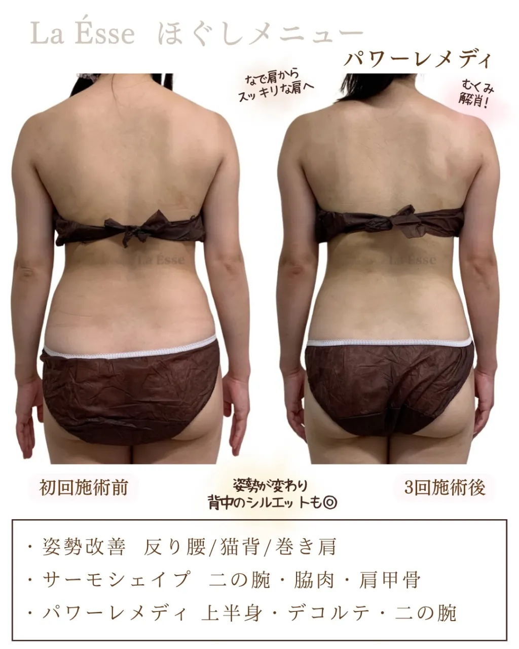 ３回筋膜リリースでなで肩から卒業へ✨ 背中スッキリ‼️