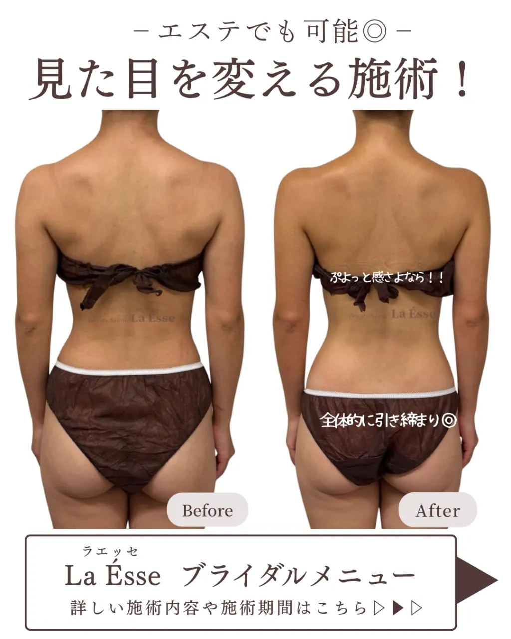 本気変わりたい花嫁様、ラエッセにおまかせください👰🏻‍♀️🩵