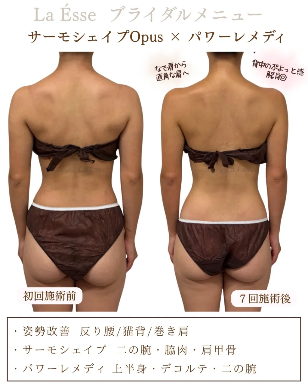 本気変わりたい花嫁様、ラエッセにおまかせください👰🏻‍♀️🩵