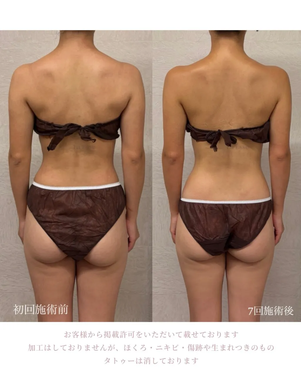 本気変わりたい花嫁様、ラエッセにおまかせください👰🏻‍♀️🩵