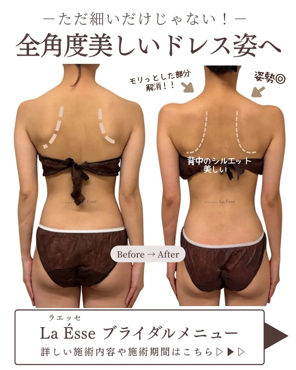 花嫁様必見!360度全方位華奢感つくれます👰🏻♀️✨
