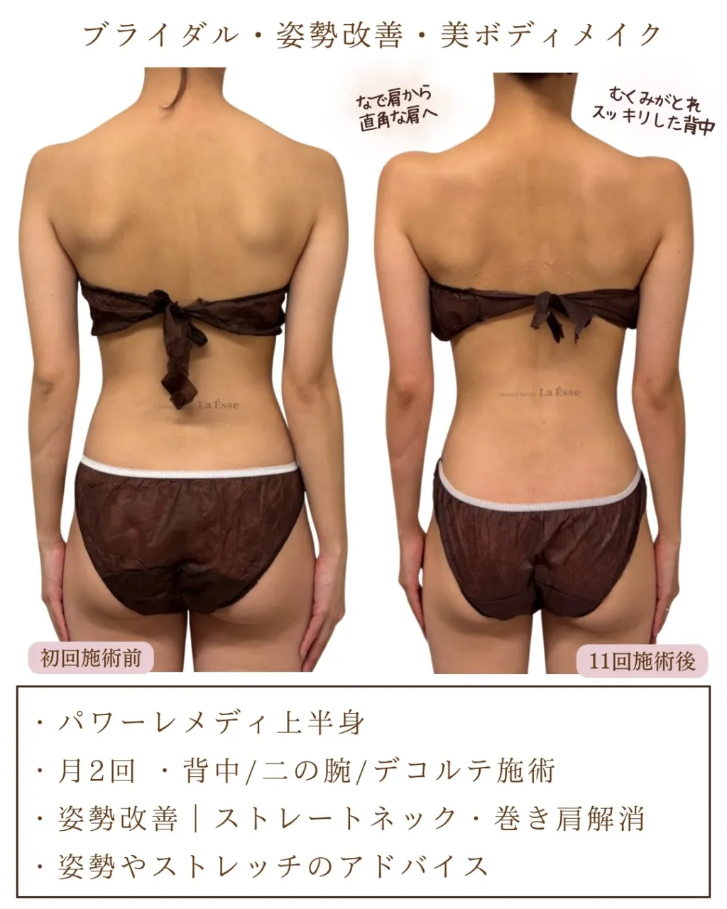 花嫁様必見！360度全方位華奢感つくれます👰🏻‍♀️✨
