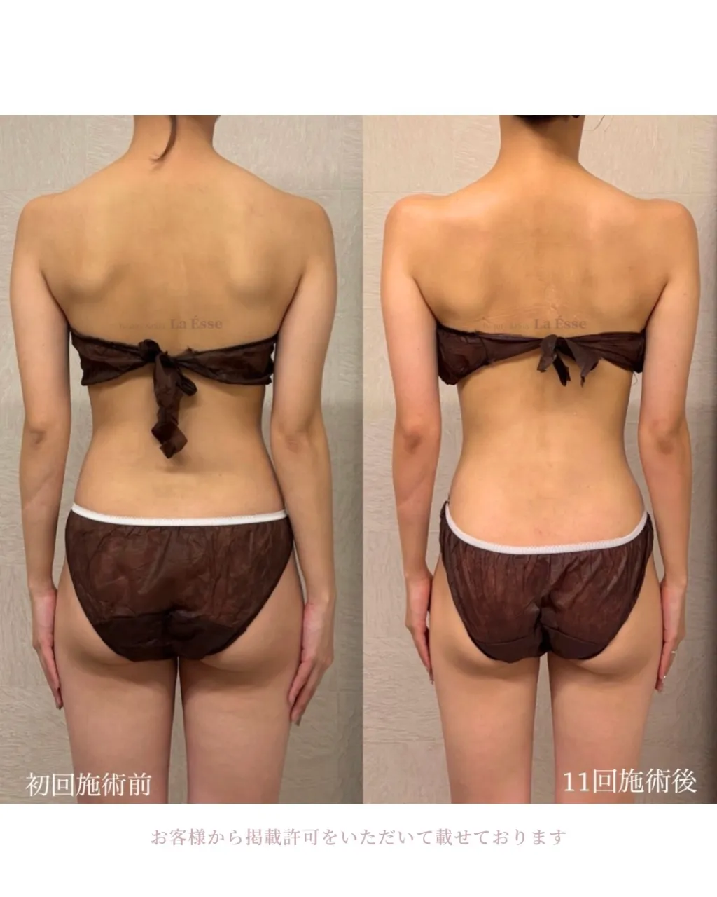 花嫁様必見！360度全方位華奢感つくれます👰🏻‍♀️✨